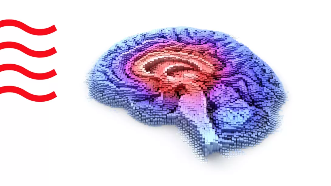 Panel Photo - focusing on a specific area of brain